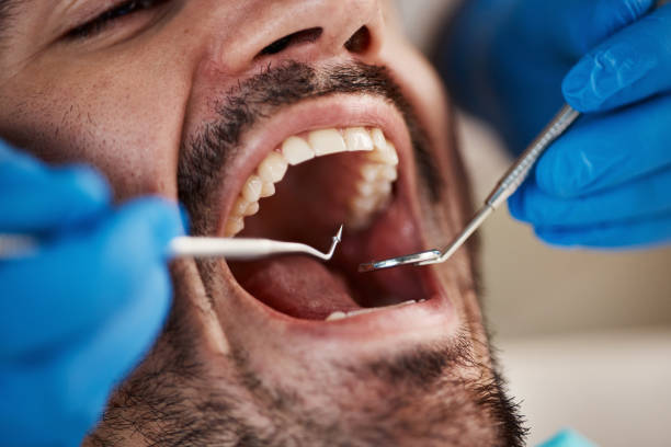 Best Emergency Treatment for Toothache in Hideo, UT